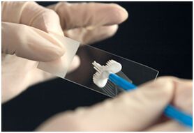Test PAPA pentru infecția cu papilomavirus