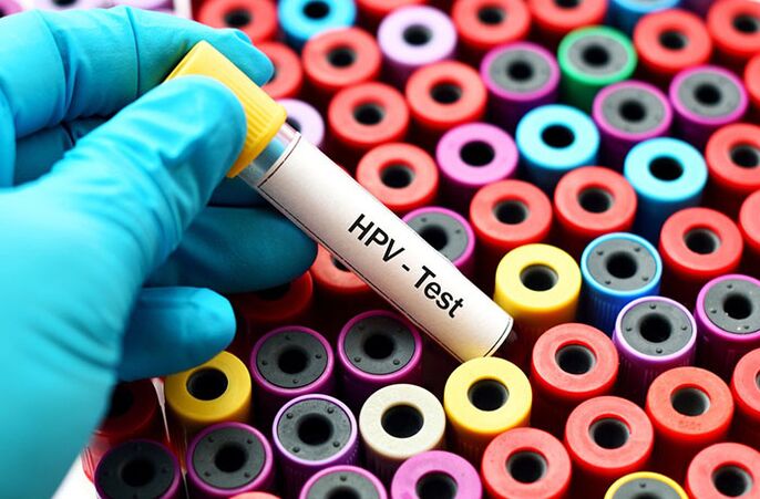 Test de sânge pentru virusul papiloma uman